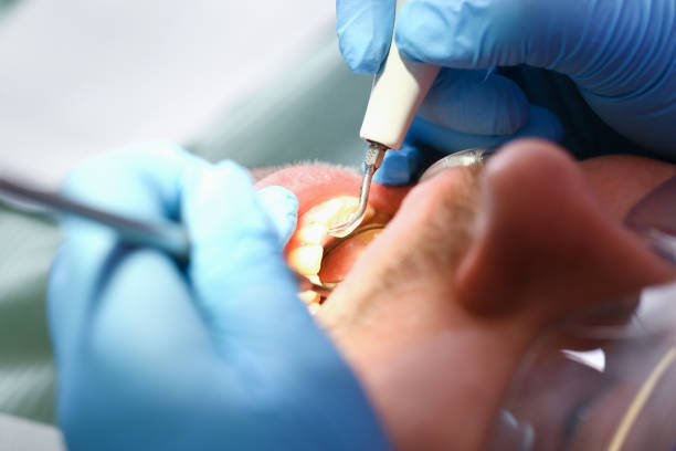 Best Emergency Root Canal Treatment in Mountainside, NJ