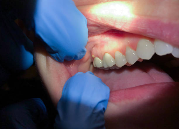 Best Emergency Dental Services for Seniors in Mountainside, NJ