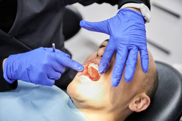 Best Emergency Dentist for Knocked-Out Tooth in Mountainside, NJ